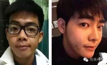 男网红整容脸吃瓜,吃瓜群众围观“变脸”奇观