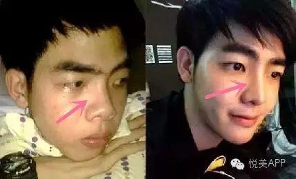 男网红整容脸吃瓜,吃瓜群众围观“变脸”奇观